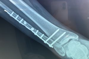 x-ray